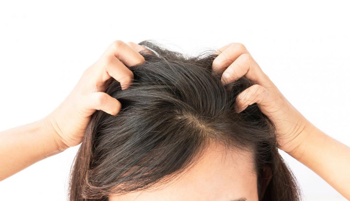 Your Scalp Needs Extra Love This Fall